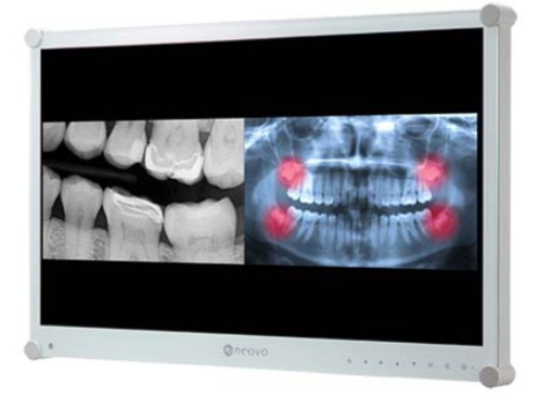 Tooth Screen AP Bison Dental | Bismarck, ND